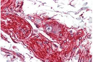 Human Nerve and Ganglion Cell (formalin-fixed, paraffin-embedded) stained with S100A10 antibody ABIN462133 followed by biotinylated anti-mouse IgG secondary antibody ABIN481714, alkaline phosphatase-streptavidin and chromogen. (S100A10 Antikörper)