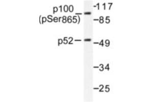Image no. 1 for anti-Nuclear Factor of kappa Light Polypeptide Gene Enhancer in B-Cells 2 (NFKB2) (pSer865) antibody (ABIN318076)