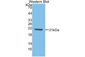 Western Blotting (WB) image for anti-Interleukin 18 Binding Protein (IL18BP) (AA 31-194) antibody (ABIN1859372) (IL18BP Antikörper  (AA 31-194))