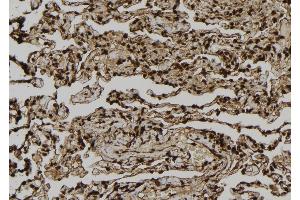 ABIN6277015 at 1/100 staining Human lung tissue by IHC-P. (Dystonin Antikörper  (C-Term))