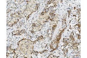 IHC analysis of USP16 using anti-USP16 antibody (ABIN7602640). (USP16 Antikörper  (AA 9-823))