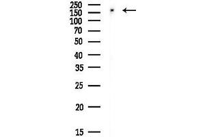 Western blot analysis of lysates from EC304 cells(heat-shock,45 min treatment), using TOP2A Antibody at 1/1000 dilution.