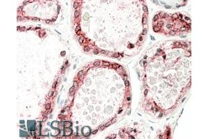 ABIN870640 (5µg/ml) staining of paraffin embedded Human Thyroid Gland. (Thyroperoxidase Antikörper  (Internal Region))