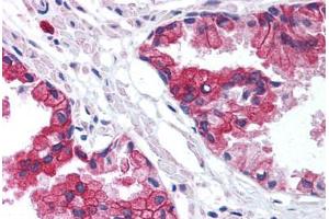 Human Prostate (formalin-fixed, paraffin-embedded) stained with TMED10 antibody ABIN214004 at 5 ug/ml followed by biotinylated goat anti-rabbit IgG secondary antibody ABIN481713, alkaline phosphatase-streptavidin and chromogen. (TMED10 Antikörper  (Internal Region))