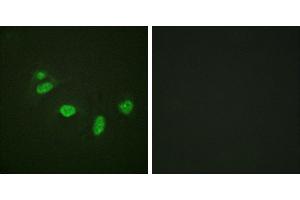 P-peptide - +Immunofluorescence analysis of HeLa cells, using ETS1 (Phospho-Thr38) antibody. (ETS1 Antikörper  (pThr38))