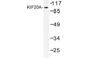 Image no. 1 for anti-Kinesin Family Member 20A (KIF20A) antibody (ABIN317796) (KIF20A Antikörper)