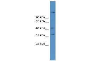 WB Suggested Anti-SYT11 Antibody Titration: 0.