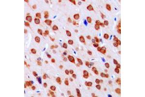Immunohistochemical analysis of DCLK3 staining in human brain formalin fixed paraffin embedded tissue section. (DCLK3 Antikörper  (Center))