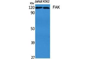 Western Blot (WB) analysis of specific cells using FAK Polyclonal Antibody. (FAK Antikörper  (Thr435))
