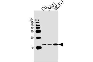 Lane 1: C6 Cell Lysates, Lane 2: A431 Cell Lysates, Lane 3: MCF-7 Cell Lysates, probed with NRAS (822CT17. (GTPase NRas Antikörper)