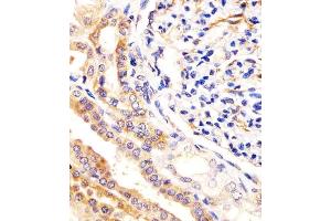 (ABIN388879 and ABIN2850431) staining USP2 in human kidney tissue sections by Immunohistochemistry (IHC-P - paraformaldehyde-fixed, paraffin-embedded sections). (USP2 Antikörper  (C-Term))