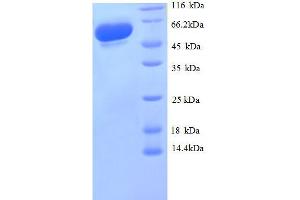Glyceraldehyde-3-Phosphate Dehydrogenase (GAPDH) (AA 3-335), (partial) protein (GST tag) (GAPDH Protein (AA 3-335, partial) (GST tag))