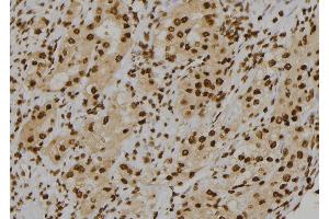 ABIN6277118 at 1/100 staining Human kidney tissue by IHC-P. (Cullin 1 Antikörper)