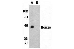Western Blotting (WB) image for anti-Chemokine (C-X-C Motif) Receptor 6 (CXCR6) (N-Term) antibody (ABIN1031691) (CXCR6 Antikörper  (N-Term))