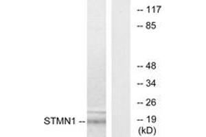 Western blot analysis of extracts from COS7 cells, using Stathmin 1 (Ab-15) Antibody. (Stathmin 1 Antikörper  (AA 5-54))