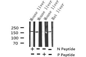 Western blot analysis of Phospho-EGFR (Thr693) expression in various lysates (EGFR Antikörper  (pThr693))