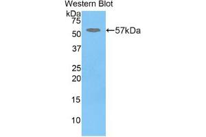 Western blot analysis of the recombinant protein. (GBA Antikörper  (AA 248-508))