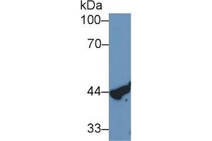 Detection of CTSD in Rat Kidney lysate using Monoclonal Antibody to Cathepsin D (CTSD) (Cathepsin D Antikörper  (AA 21-412))