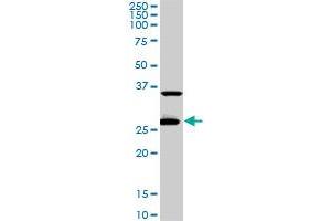CITED1 monoclonal antibody (M02), clone 6C1. (CITED1 Antikörper  (AA 94-193))