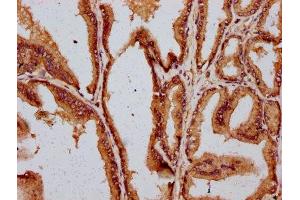 IHC image of ABIN7149497 diluted at 1:400 and staining in paraffin-embedded human prostate tissue performed on a Leica BondTM system. (DAZAP2 Antikörper  (AA 1-168))