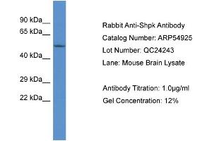 Western Blotting (WB) image for anti-Sedoheptulokinase (SHPK) (Middle Region) antibody (ABIN2785956) (SHPK Antikörper  (Middle Region))