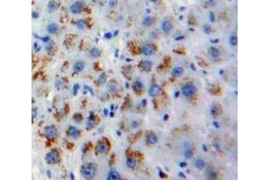 IHC-P analysis of Liver tissue, with DAB staining. (OLR1 Antikörper  (AA 81-273))