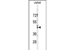Western Blotting (WB) image for anti-Gap Junction Protein, alpha 3, 46kDa (GJA3) (AA 108-139), (N-Term) antibody (ABIN5534077)