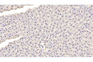 Immunohistochemistry (IHC) image for anti-Fatty Acid Binding Protein 1, Liver (FABP1) (AA 1-127) antibody (ABIN7440617)