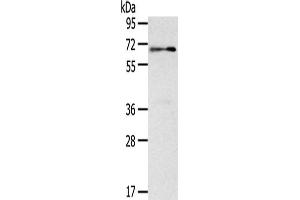 Gel: 8 % SDS-PAGE,Lysate: 40 μg,Primary antibody: ABIN7131054(SIGLEC12 Antibody) at dilution 1/500 dilution,Secondary antibody: Goat anti rabbit IgG at 1/8000 dilution,Exposure time: 1 minute (SIGLEC12 Antikörper)