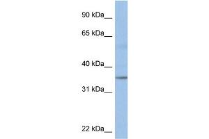 WB Suggested Anti-KCTD4 Antibody Titration:  0. (KCTD4 Antikörper  (Middle Region))