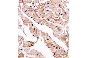 Immunohistochemical analysis of paraffin-embedded H. (SGCG Antikörper  (AA 145-172))