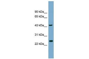 FLJ25439 antibody used at 1 ug/ml to detect target protein. (TTC23L Antikörper  (N-Term))