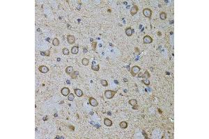 Immunohistochemistry (Paraffin-embedded Sections) (IHC (p)) image for anti-Cadherin-16 (CDH16) (AA 19-230) antibody (ABIN6138291)