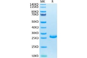 SDS-PAGE (SDS) image for Fibroblast Growth Factor 21 (FGF21) (AA 29-210) protein (His tag) (ABIN7274637)