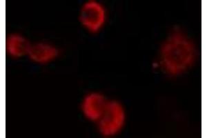 ABIN6274180 staining HuvEc cells by IF/ICC. (ZNF24 Antikörper  (Internal Region))