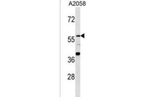 ZN Antibody (N-term) (ABIN1539362 and ABIN2849856) western blot analysis in  cell line lysates (35 μg/lane). (ZNF776 Antikörper  (N-Term))