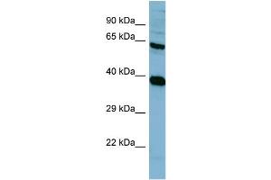 Western Blotting (WB) image for anti-Protein Phosphatase 2, Regulatory Subunit A, alpha (PPP2R1A) (N-Term) antibody (ABIN2787389) (PPP2R1A Antikörper  (N-Term))