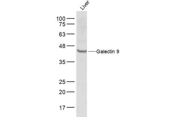 Galectin 9 Antikörper  (AA 51-150)