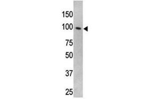 TLR5 antibody used in western blot to detect TLR5 in HL-60 cell lysate (TLR5 Antikörper  (AA 71-102))
