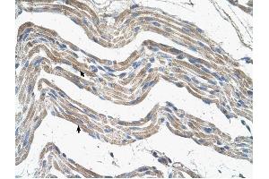IDH3A antibody was used for immunohistochemistry at a concentration of 4-8 ug/ml to stain Skeletal muscle cells (arrows) in Human Muscle. (IDH3A Antikörper)