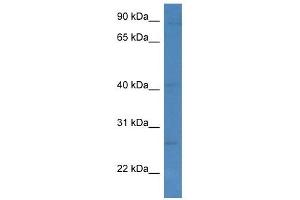 Western Blot showing KLRC1 antibody used at a concentration of 1 ug/ml against MCF7 Cell Lysate (KLRC1 Antikörper  (C-Term))