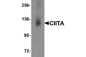 Western Blotting (WB) image for anti-Class II, Major Histocompatibility Complex, Transactivator (CIITA) (N-Term) antibody (ABIN1031320) (CIITA Antikörper  (N-Term))