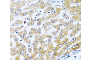 Immunohistochemistry of paraffin-embedded Human liver using CCL21 Polyclonal Antibody at dilution of 1:100 (40x lens). (CCL21 Antikörper)