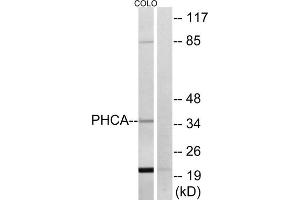 Western blot analysis of extracts from COLO cells, using PHCA antibody. (ACER3 Antikörper  (Internal Region))