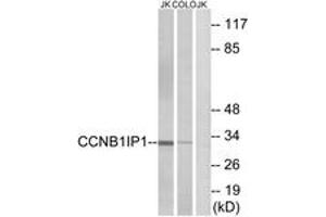 Western blot analysis of extracts from Jurkat/COLO cells, using CCNB1IP1 Antibody. (CCNB1IP1 Antikörper  (AA 201-250))