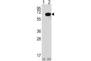 Western Blotting (WB) image for anti-Heat Shock 70kDa Protein 1A (HSPA1A) antibody (ABIN3003299) (HSP70 1A Antikörper)