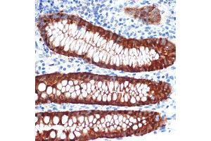 Immunohistochemistry of paraffin-embedded human appendix using Galectin 4/LG Rabbit mAb (ABIN1679347, ABIN3017979, ABIN3017980 and ABIN7101554) at dilution of 1:100 (40x lens). (GAL4 Antikörper)