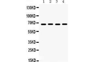 Western Blotting (WB) image for anti-Ets Variant 4 (ETV4) (AA 1-41), (N-Term) antibody (ABIN3042379) (ETV4 Antikörper  (N-Term))