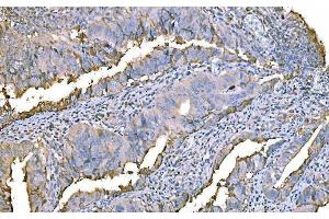 IHC analysis of Prothrombin using anti-Prothrombin antibody (ABIN7602705). (Prothrombin Fragment 2 (AA 97-124) Antikörper)