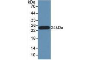 Detection of Recombinant PTa, Human using Polyclonal Antibody to Pancreas Specific Transcription Factor 1a (PTF1a) (PTF1A Antikörper  (AA 177-328))